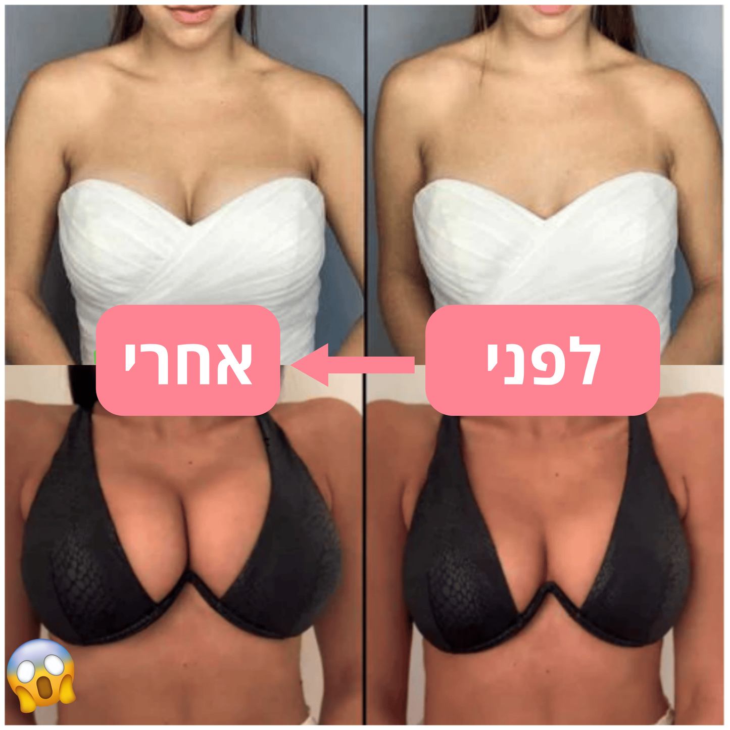 ™NEW-BOOBS - מדבקות הגדלת & הרמת החזה המהפכניות