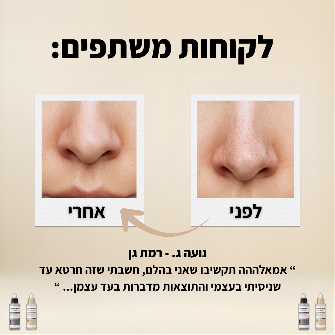 ™PEEL-SHOT - מארז הסרת השחורים המהפכני של ד"ר מלקסין