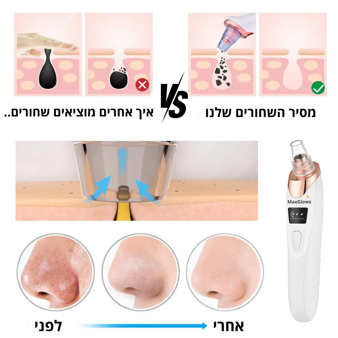 ™BLACK-OUT - מסיר השחורים המהפכני.