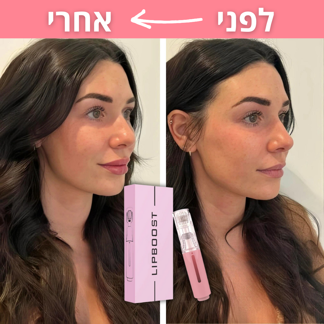 ™LIP-GLOW - רולר הגדלת & שיקום השפתיים.